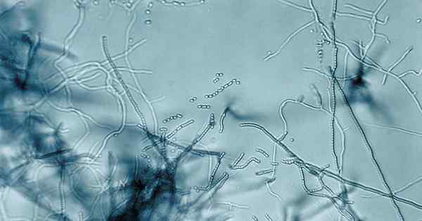 Cara menggunakan Streptomyces lydicus untuk mengendalikan penyakit tanaman jamur