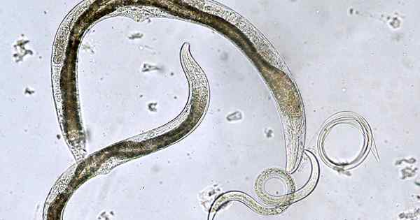 Cara menggunakan nematoda yang menguntungkan untuk mengurangi hama di kebun Anda